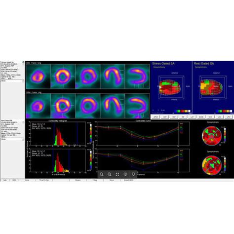 nuclear medicine software